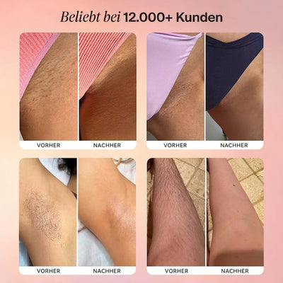 CliniDerm™ 2-in-1 Damen Körperrasierer